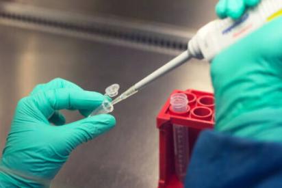 Situation im Labor: Zwei Hände bedienen eine Pipette.